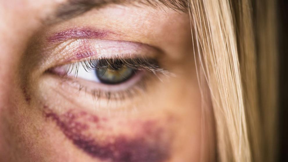 Refuerza Gobierno del Estado acciones para prevenir la violencia contra las mujeres durante la contingencia