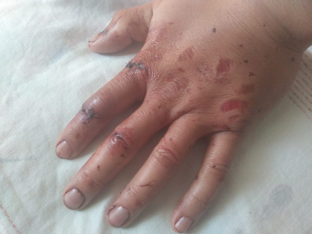 Apaleado por vecino incómodo