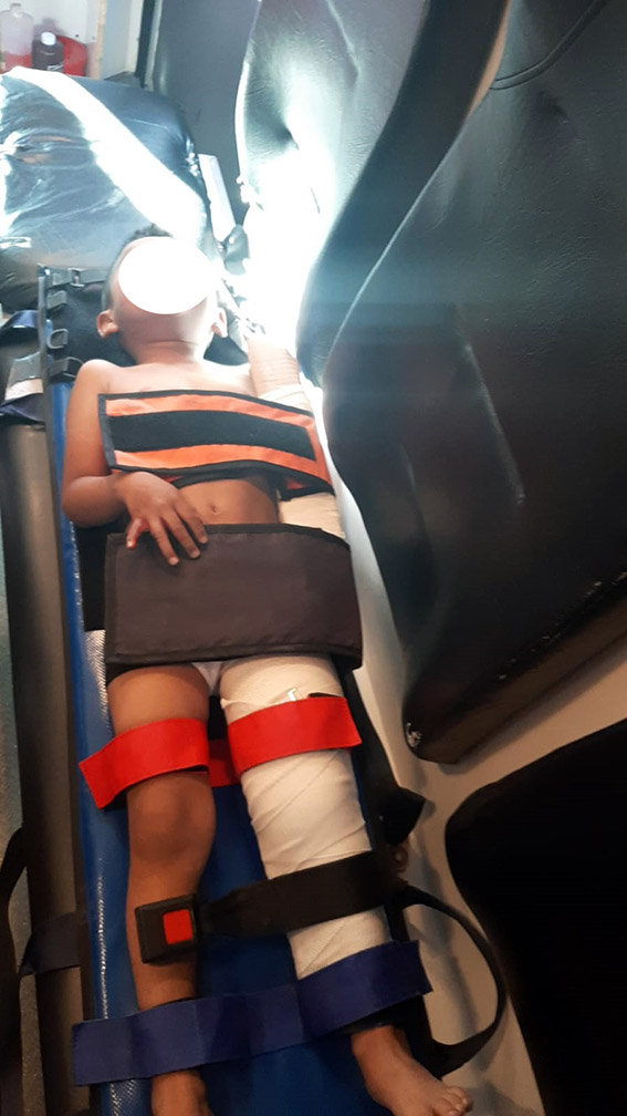 Familia atropellada en Cuachayotla