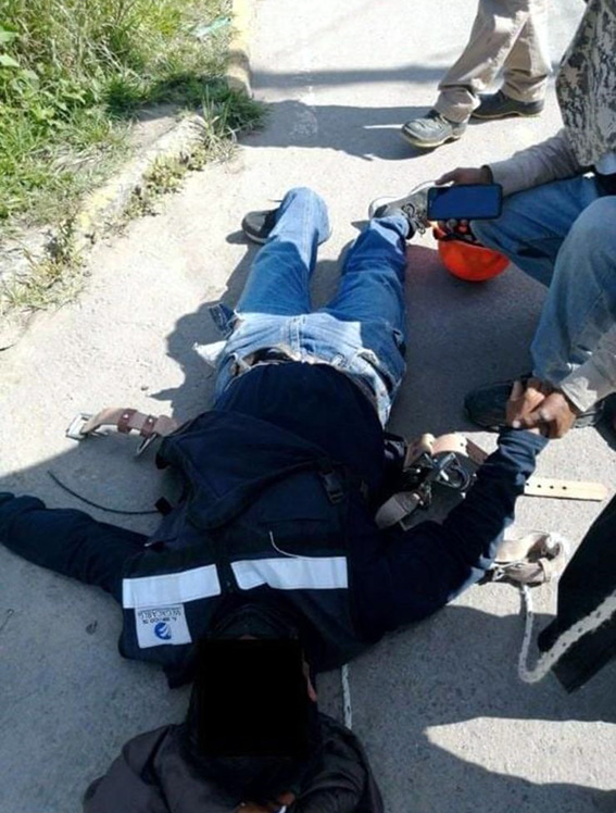 Cayó de escalera, se fractura ambos pies