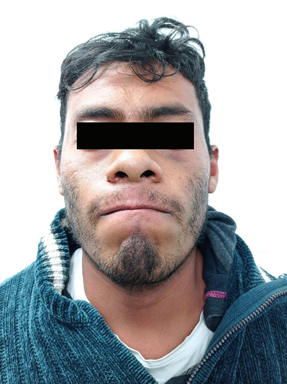 Eran sus suegros, los decapitados