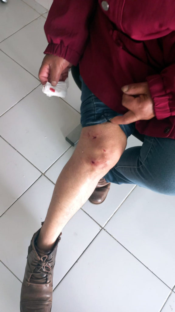 Mujer agredida por perro en la 7 Poniente