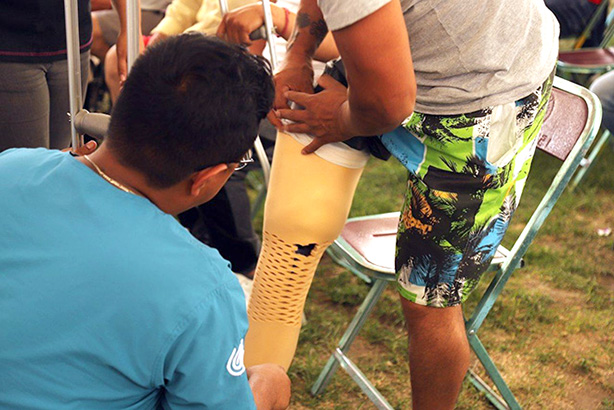DIF entrega 15 prótesis y 7 ortesis a través del programa cambiando vidas