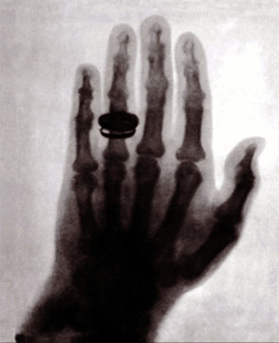 Día Mundial de la Radiología