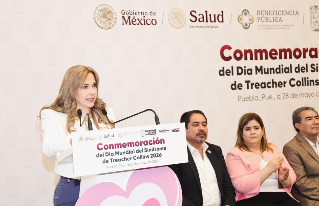 SEDIF y Beneficencia Pública Nacional transforman vidas de niñas y niños con Síndrome de Treacher Collins